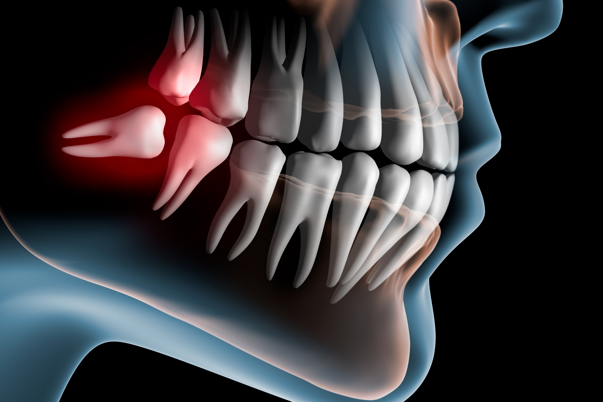 fachzahnarzt oralchirurgie Zahnfleischoperationen wassermuehle stuhr